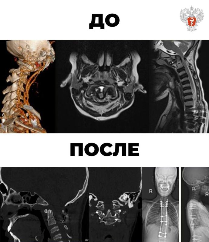 Специалисты федерального центра Минздрава России вернули возможность ходить парализованному подростку