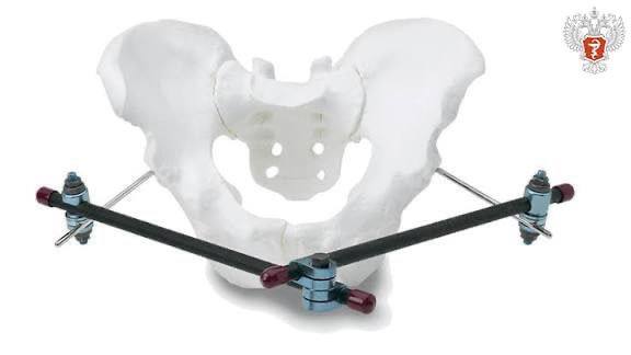 Воронежские травматологи сохранили женщине возможность ходить после тяжёлой травмы на тюбинге Воронежские травматологи сохранили женщине возможность ходить после тяжёлой травмы на тюбинге